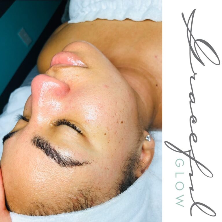 photo.html 910 768x768